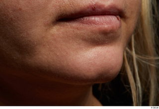 HD Face Skin Finley Newman chin face lips mouth skin…